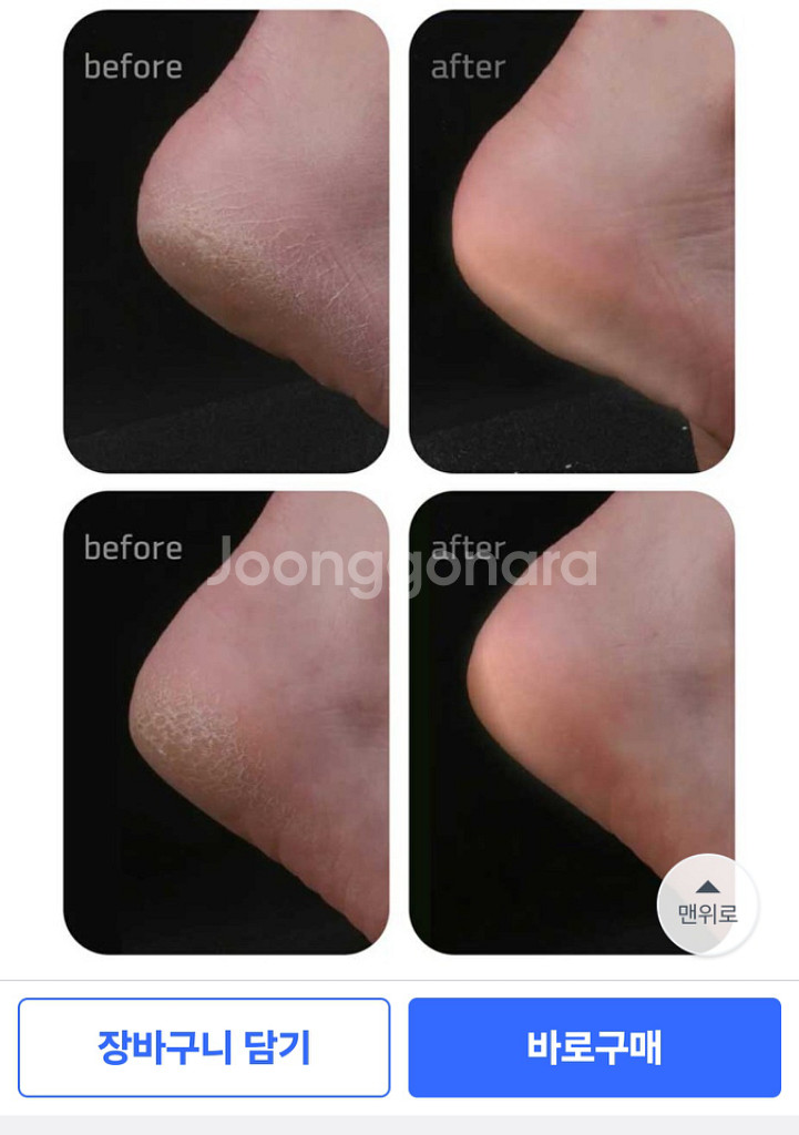 베베풋 글라스 발 각질제거기--2