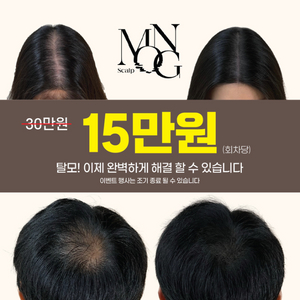 탈리 관리 이벤트 30->15만원