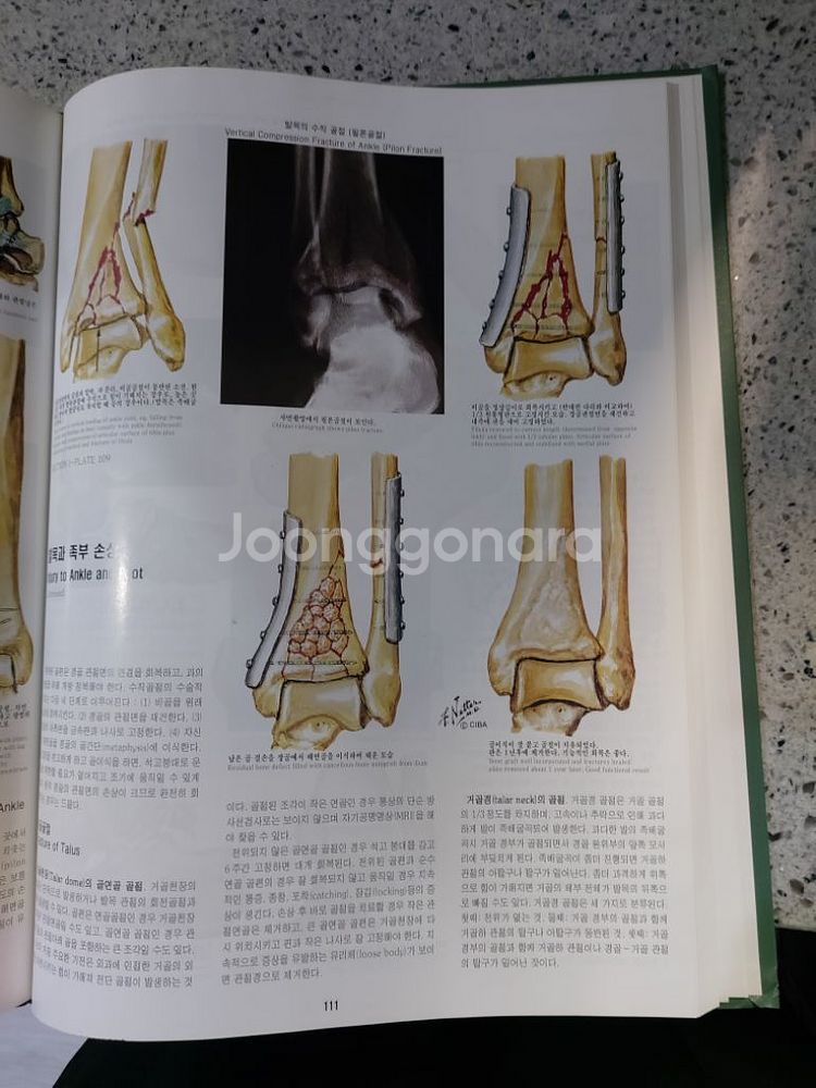 CIBA 원색도해의학총서 13권 택비포함 49000원--4