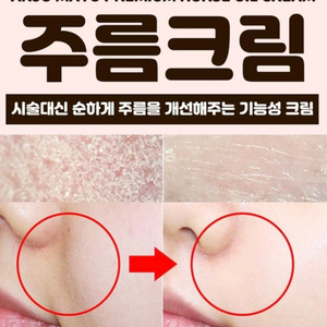 주름크림