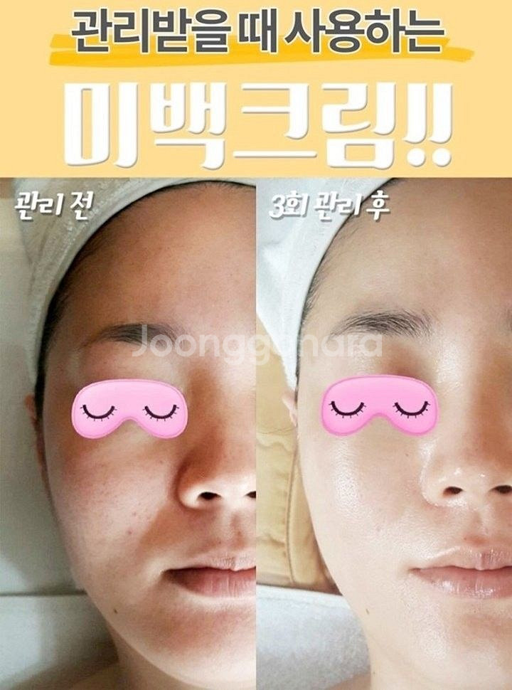 고농축 스킨에셋 슈퍼 프라임 화이트닝 기미크림 50gX--7