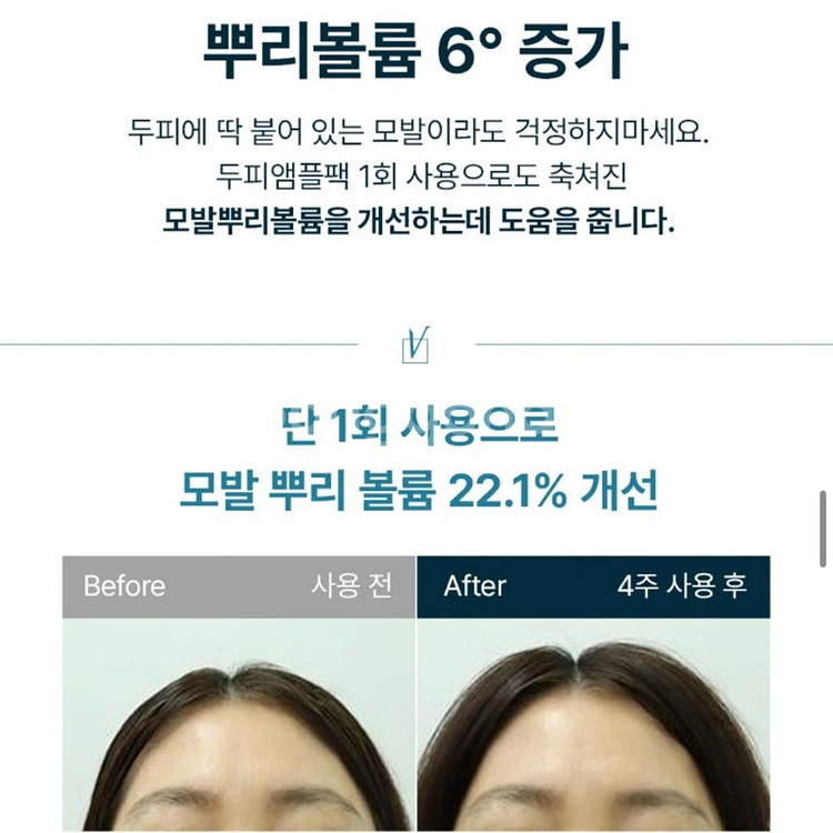 [무배/새상품] 솔랩 탈모증상완화 가르마앰플 두피영양제--6