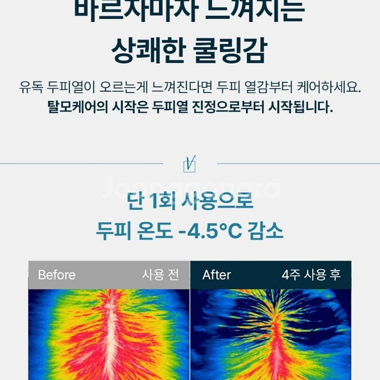 [무배/새상품] 솔랩 탈모증상완화 가르마앰플 두피영양제--7