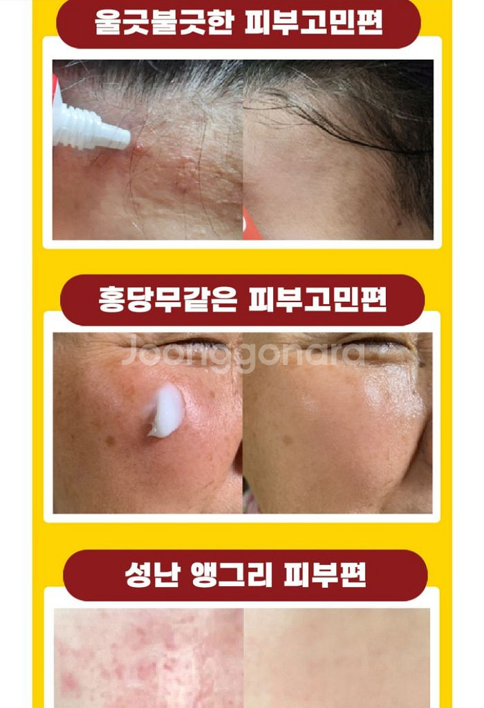 기미잡티제거크림 2개 트러블크림 안면홍조 미백특허성분--4