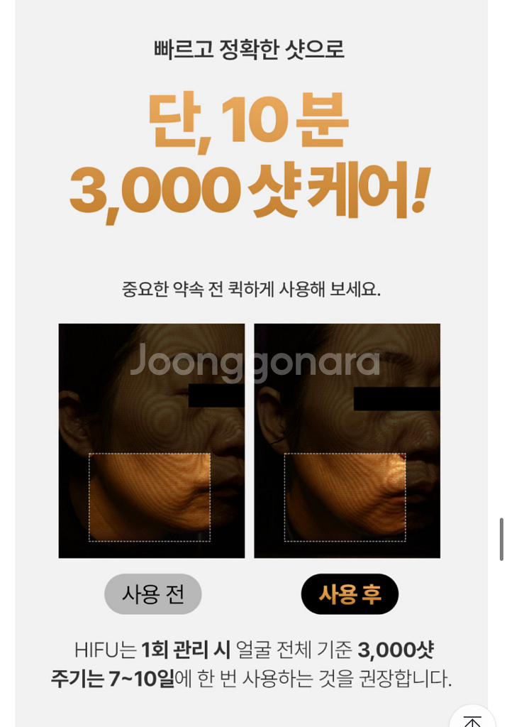 (림프순환 짱) 하이소닉 S 클레어 듀얼 물방울 초음파--3