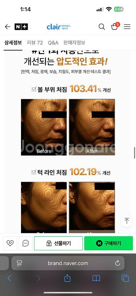 (림프순환 짱) 하이소닉 S 클레어 듀얼 물방울 초음파--4