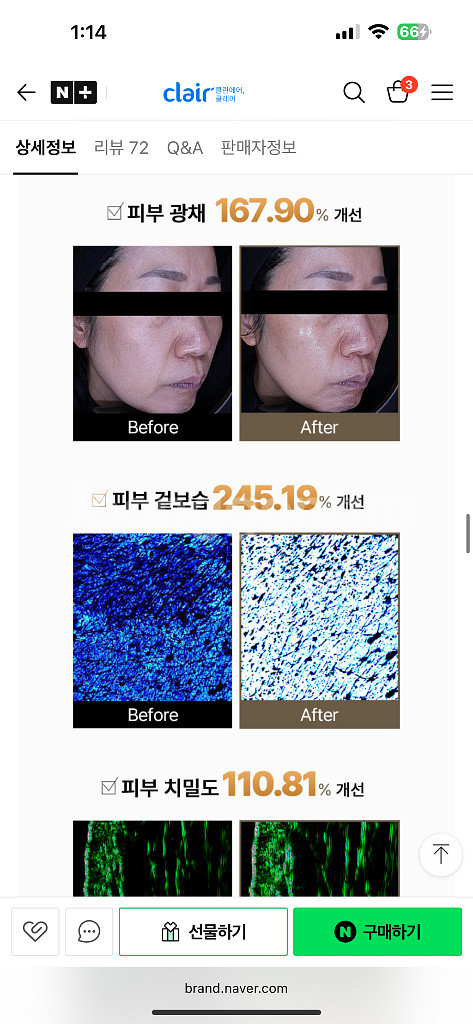 (림프순환 짱) 하이소닉 S 클레어 듀얼 물방울 초음파--5