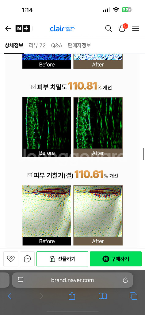 (림프순환 짱) 하이소닉 S 클레어 듀얼 물방울 초음파--6