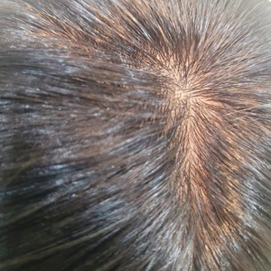 하이모 전체 통가발