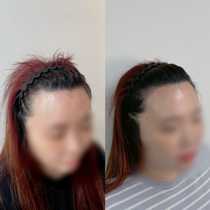 두피문신 체험 모델 모집(헤어라인/정수리/가르마)