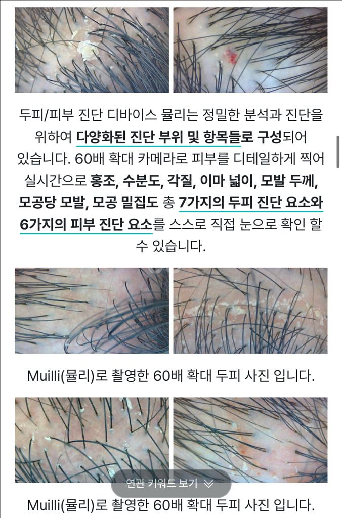 (미개봉)피부진단기 두피진단기 탈모진단기+갈바닉 아쿠아--3