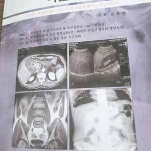 복부 영상진단 아틀라스 책