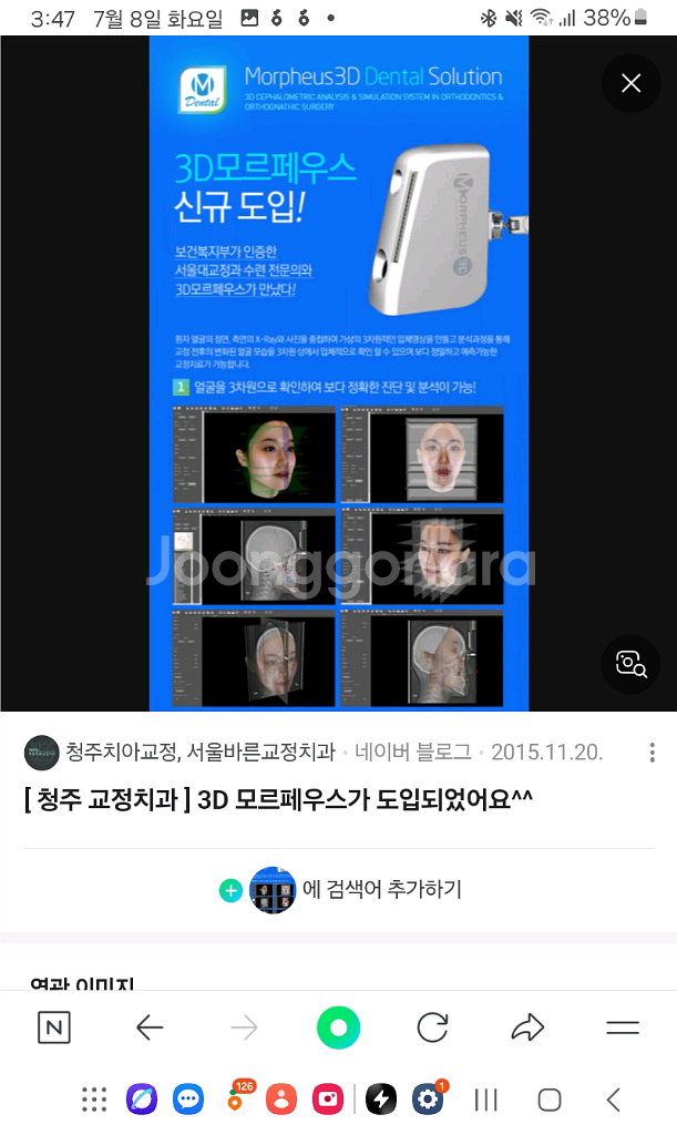 모르페우스3d 스캐너--8