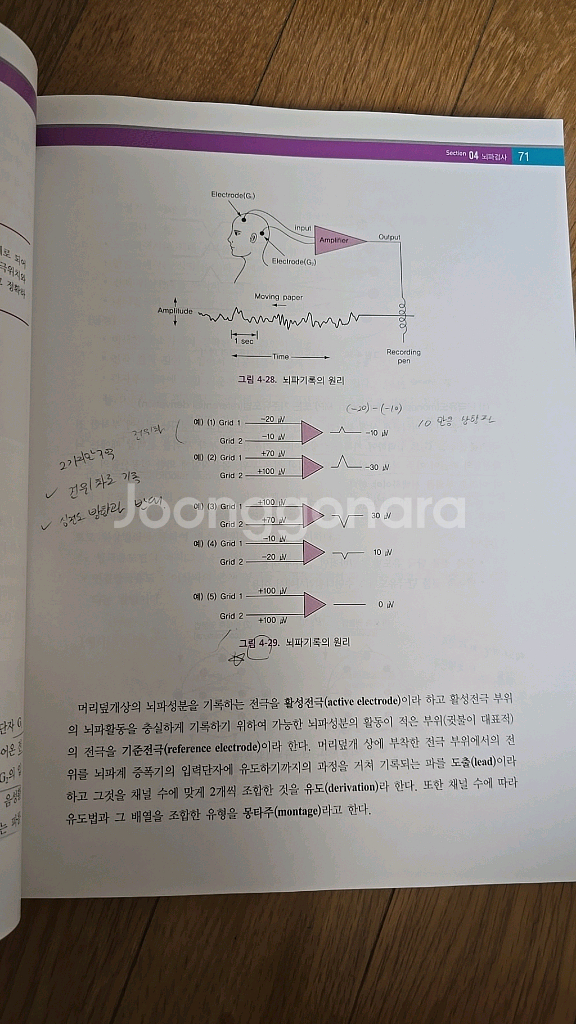신경기능검사학ㅡ고려의학--3