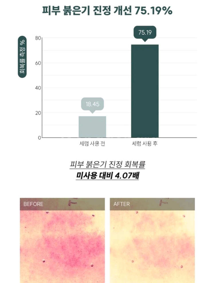 닥터트웬티프로젝트 나인 세럼 에센스 앰플 진정 장벽--2