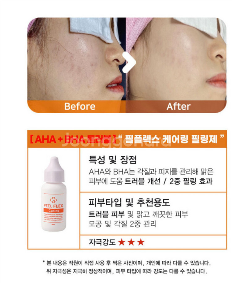 (새상품)토아스 필플렉스 얼굴 각질제거제 3종+PDRN--5