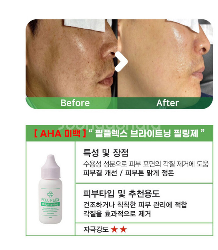 (새상품)토아스 필플렉스 얼굴 각질제거제 3종+PDRN--4