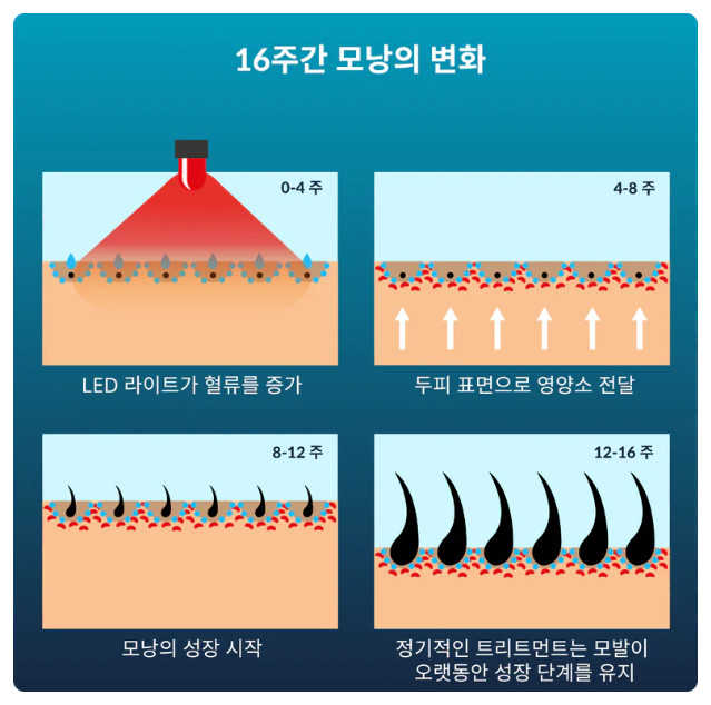 커런트바디 led 두피관리기 가정용 탈모 예방 기기--4