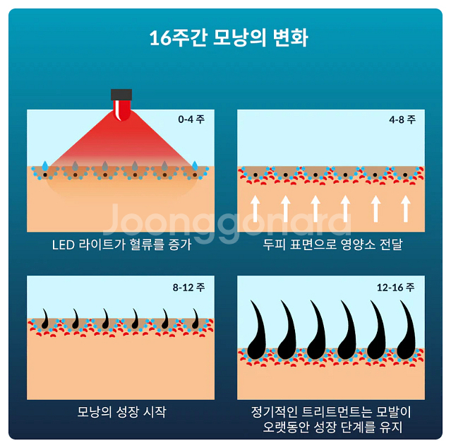 커런트바디 led 두피관리기 가정용 탈모 예방 기기--4