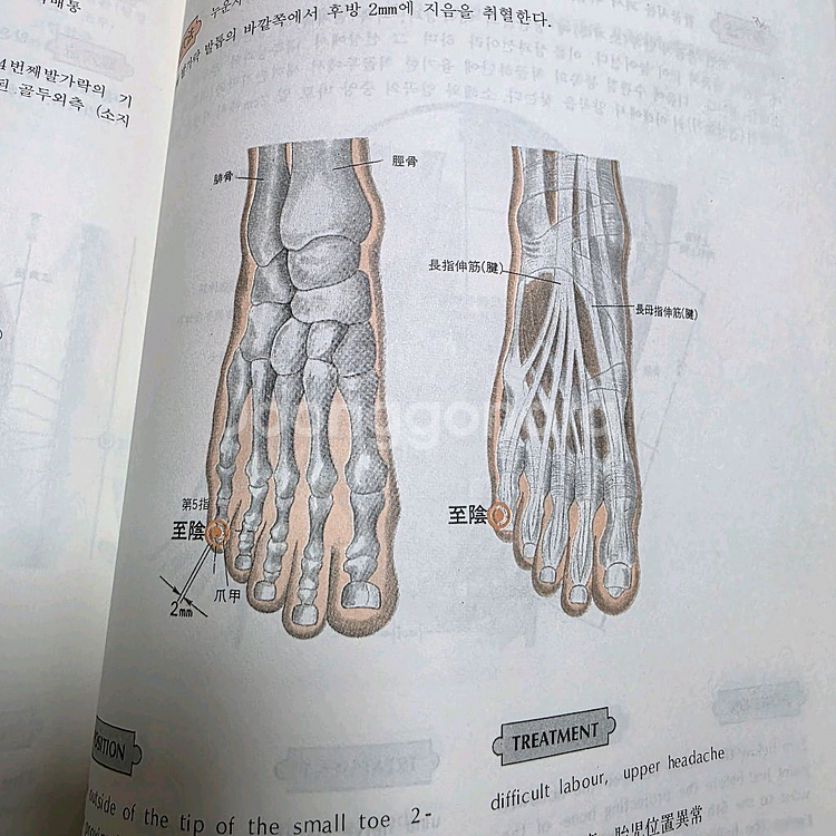 한의학 침술 뜸 혈자리 도서--5