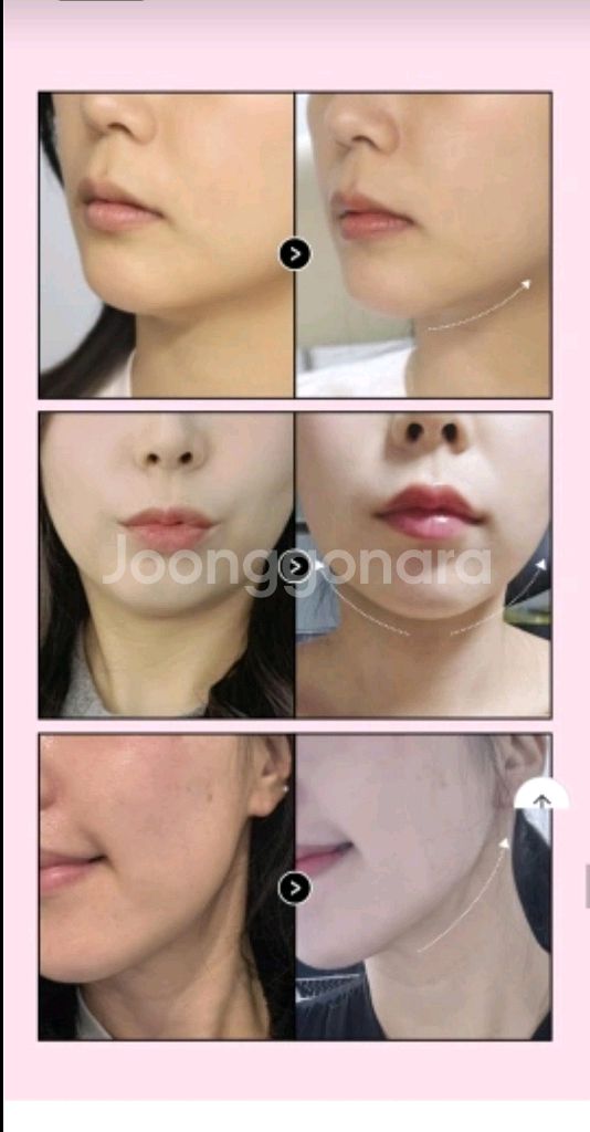 (새제품)약손명가 골기 프로그램 리프팅 밴드--4