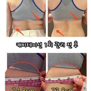 1회 관리로 사이즈 감소 가능한 캐비테이션&고주파기기