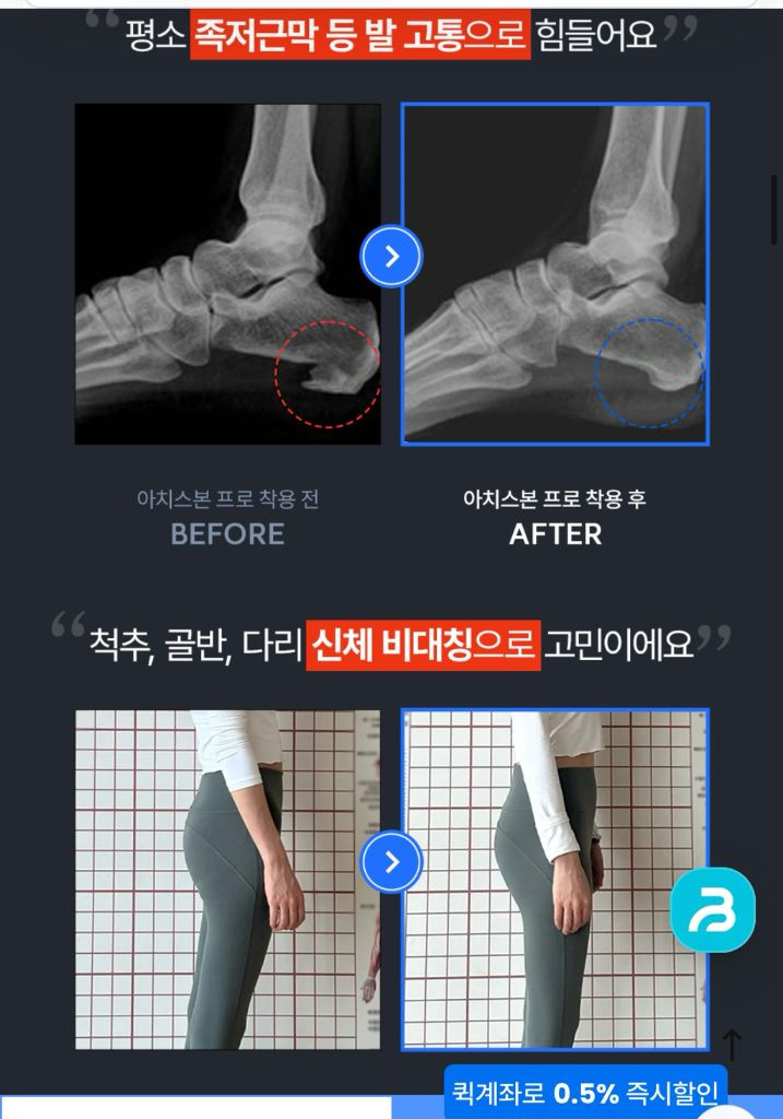 (새상품) 착용만으로 다리라인이 달라지는 발란스핏 아치 이미지