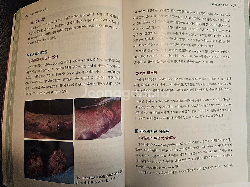 간호미생물학 고문사--1