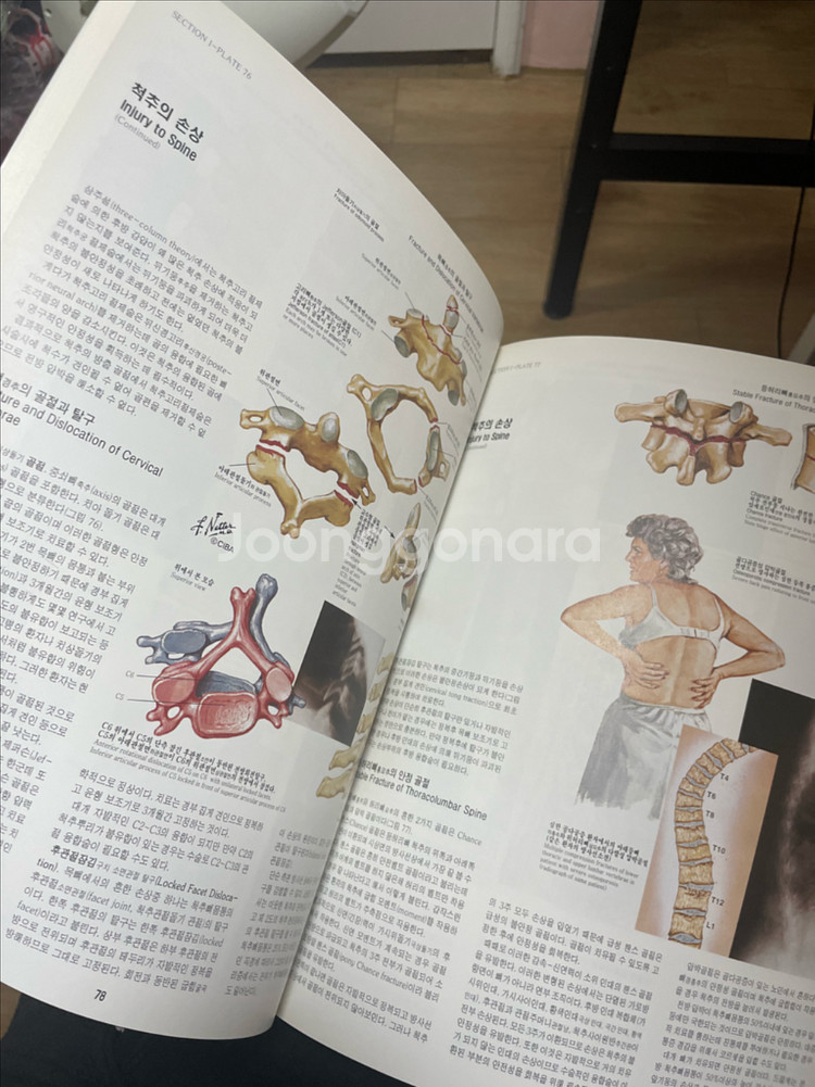 CIBA 도해의학백과 세트(의사,간호사,물치 추천)--2