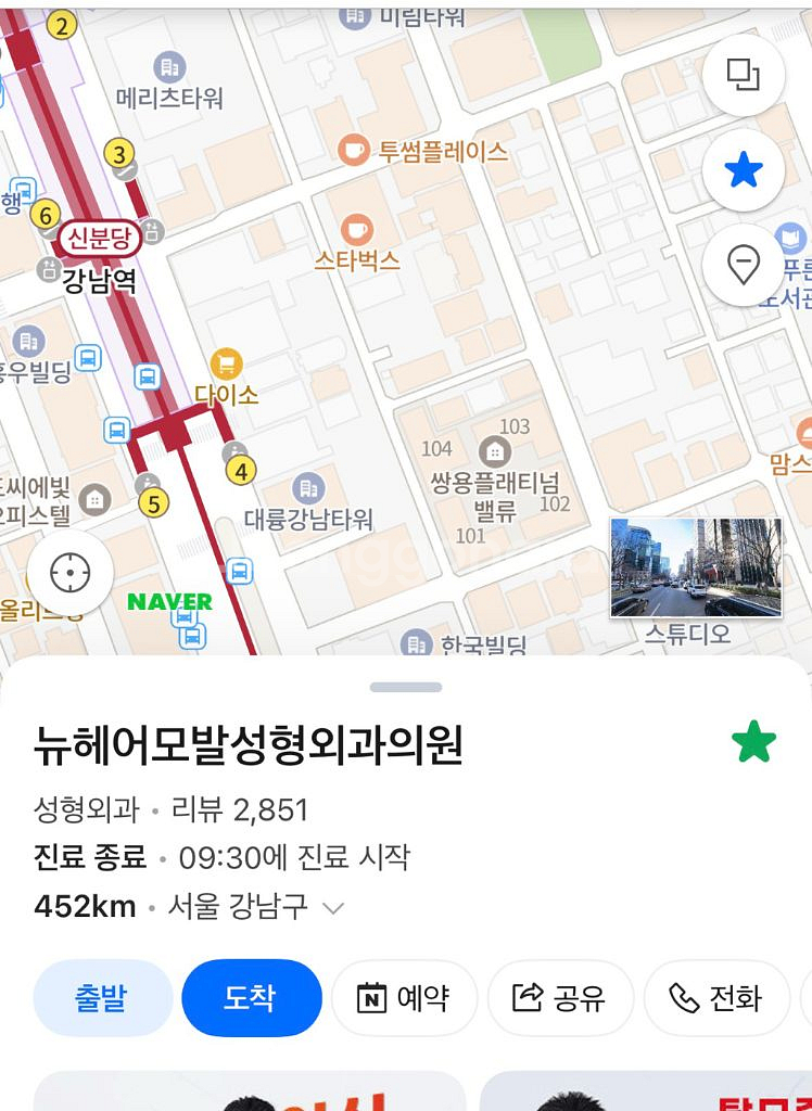 ㄴㅎㅇ 줄기세포 탈모 주사 양도합니다--0