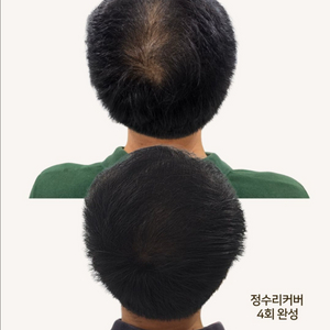 탈모 고민 끝! 정수리·가르마 확실 커버