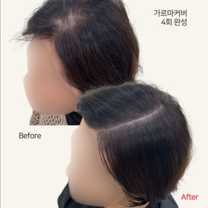 정수리 가르마 탈모커버 / 자연스러운 헤어라인