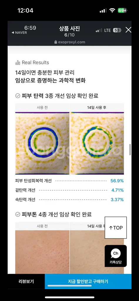 엑소프록실 시카 엑소좀 광채 20 앰플[진공포장상태]--5