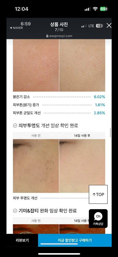 엑소프록실 시카 엑소좀 광채 20 앰플[진공포장상태]--6