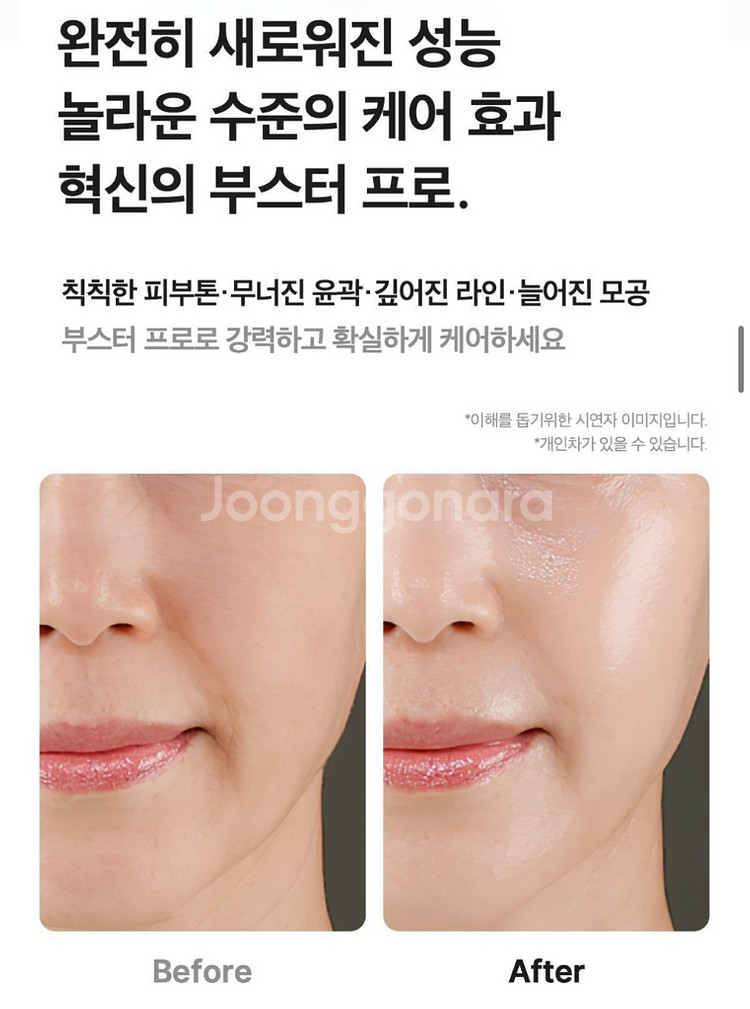 [박스미개봉] 메디큐브 에이지알 부스터프로 마이멜로디--6