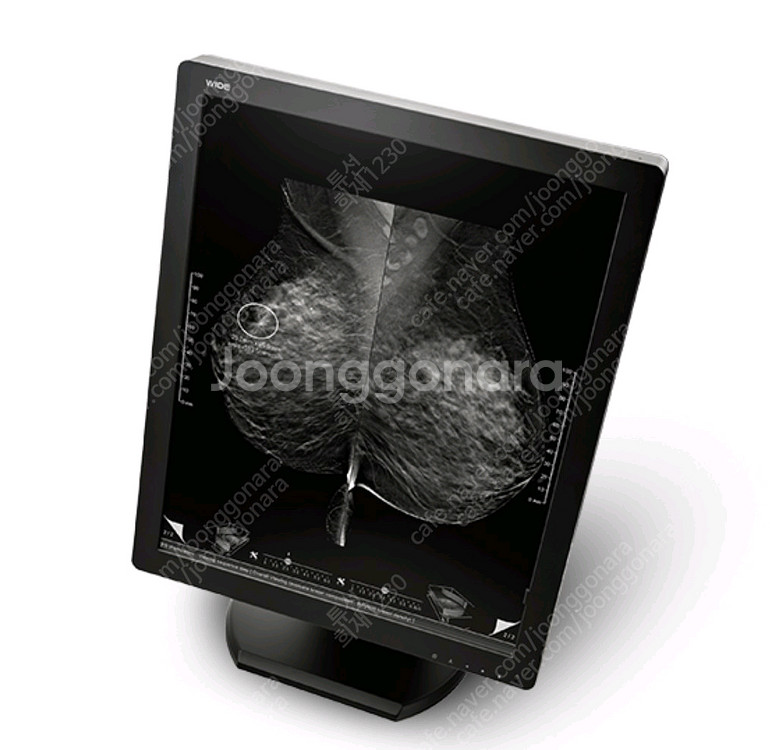 MX30NQV 병원 흑백모니터--0
