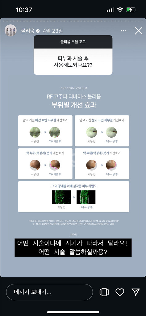 볼리움 미개봉 새상품 +젤2개미개봉 지우뷰티 지우주얼리--6