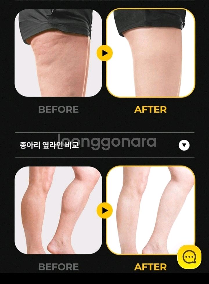 다이어트 고주파 괄사 마사지기/칼로calo슬림메이커--6