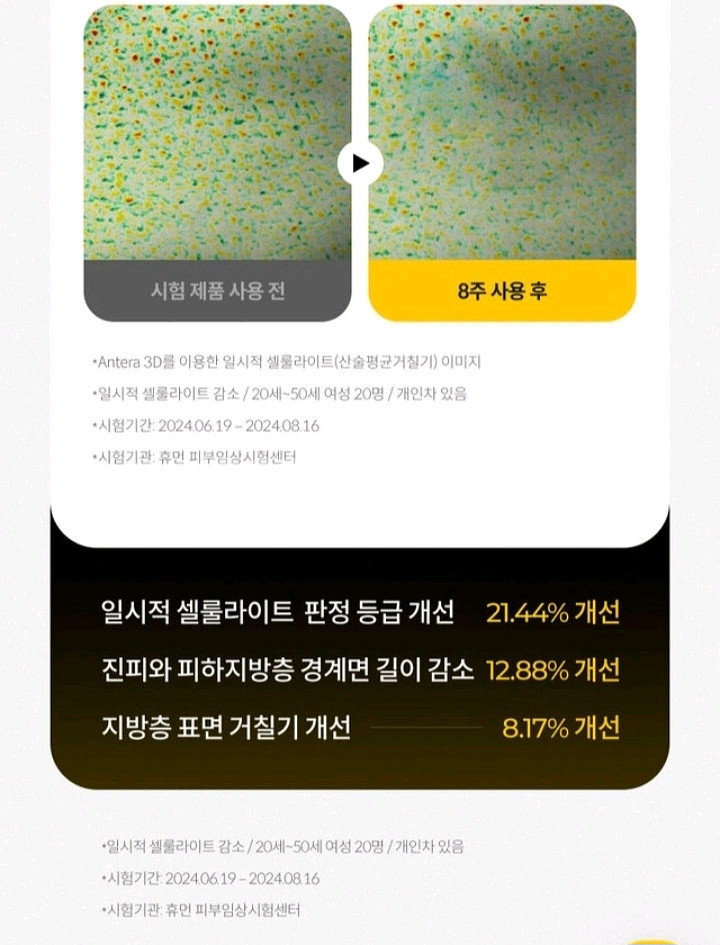다이어트 고주파 괄사 마사지기/칼로calo슬림메이커--9