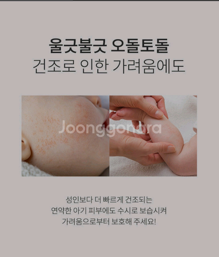 리얼더마 메디컬 릴리프 스프레이 MD 100g 새제품--4