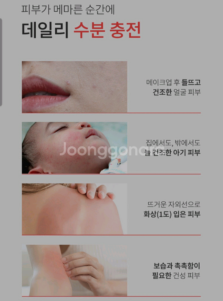 리얼더마 메디컬 릴리프 스프레이 MD 100g 새제품--3