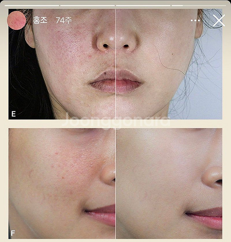 메디컬오 한의원 대구점 페이스 리액터 양도합니다--1