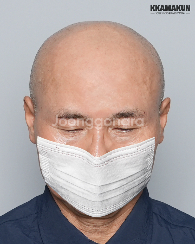 그레이시티 본점에서 두피 문신 반값에 해드립니다.--4