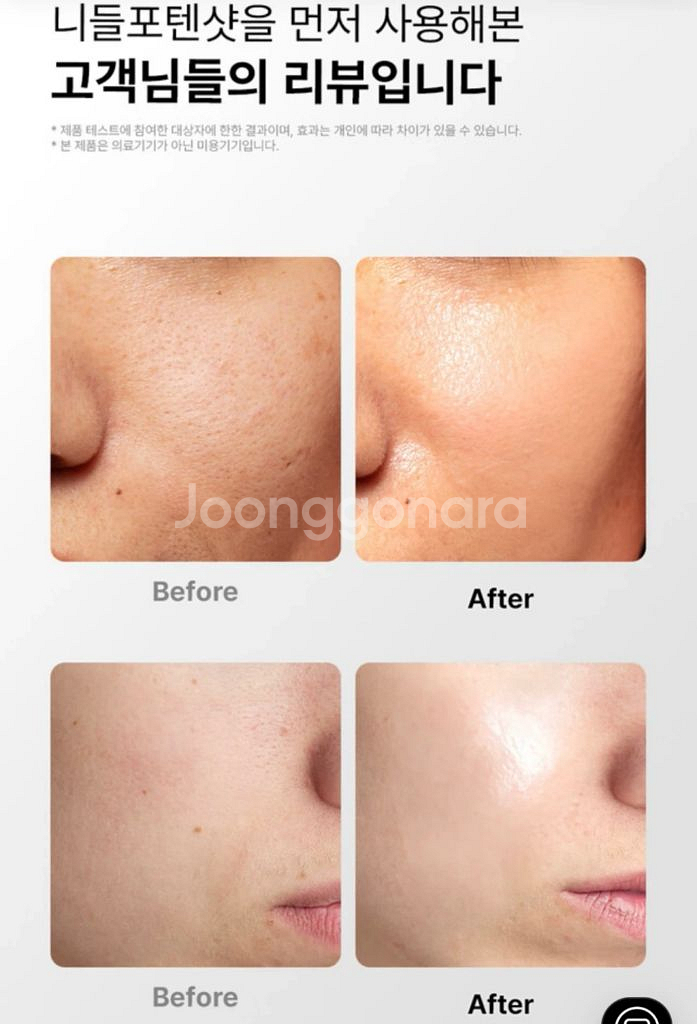 혼바디 니들포텐샷--0