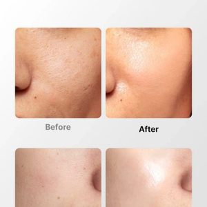 혼바디 니들포텐샷