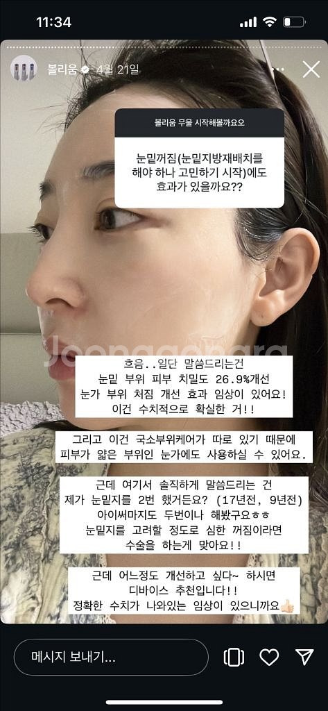 고주파 홈디바이스 클래시스 볼리움 실버 미개봉+젤2--1