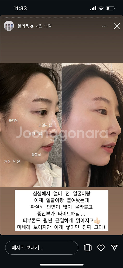 고주파 홈디바이스 클래시스 볼리움 실버 미개봉+젤2--9