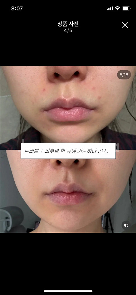 리브나 채터3 밸런스 멀티 진정 앰플--3