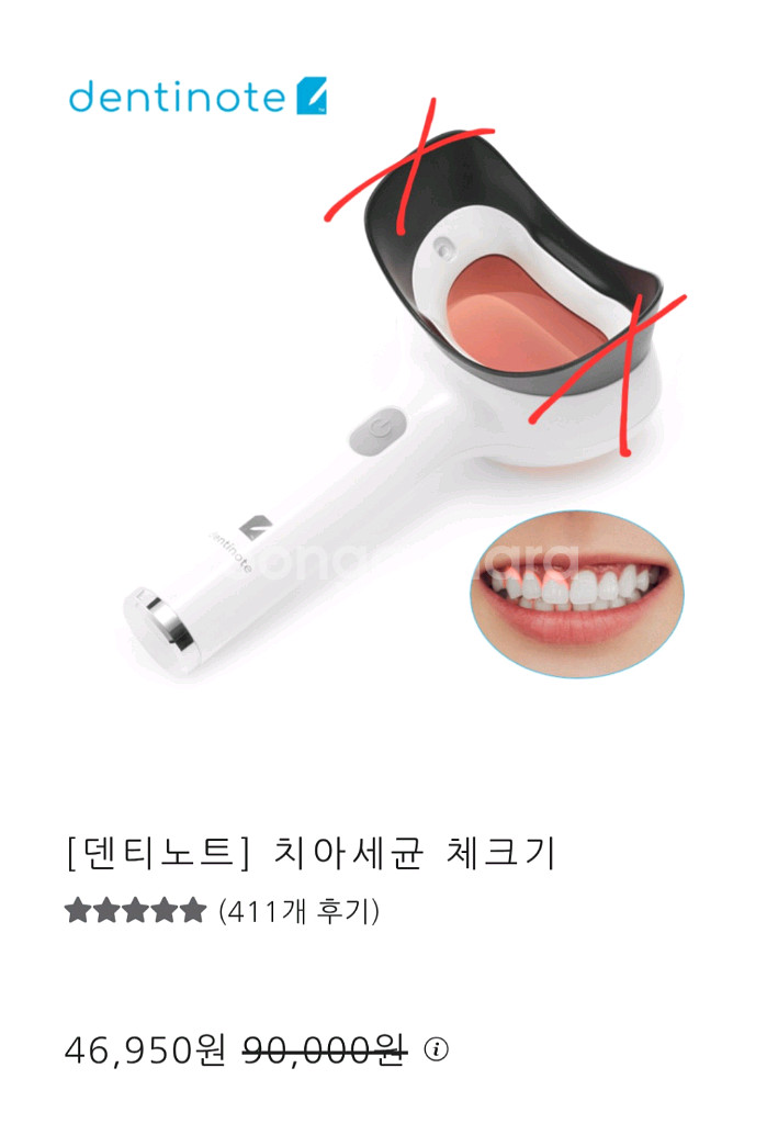 어헤드 덴탈스캐너 덴티노트, 치석확인--4