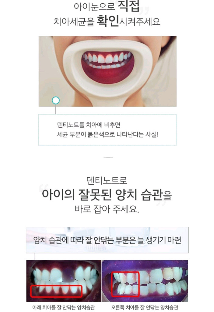 어헤드 덴탈스캐너 덴티노트, 치석확인--5